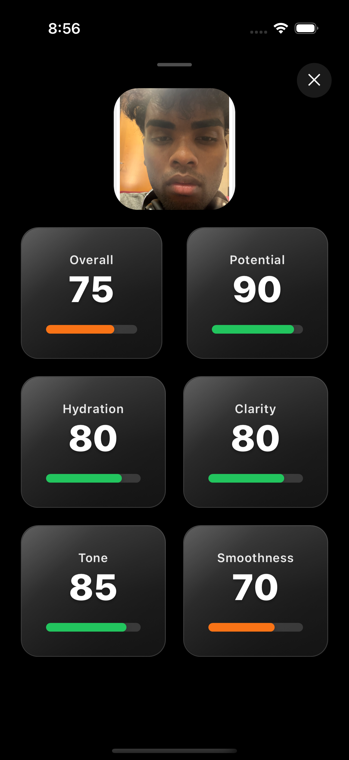 DermAI App Screenshot - Results